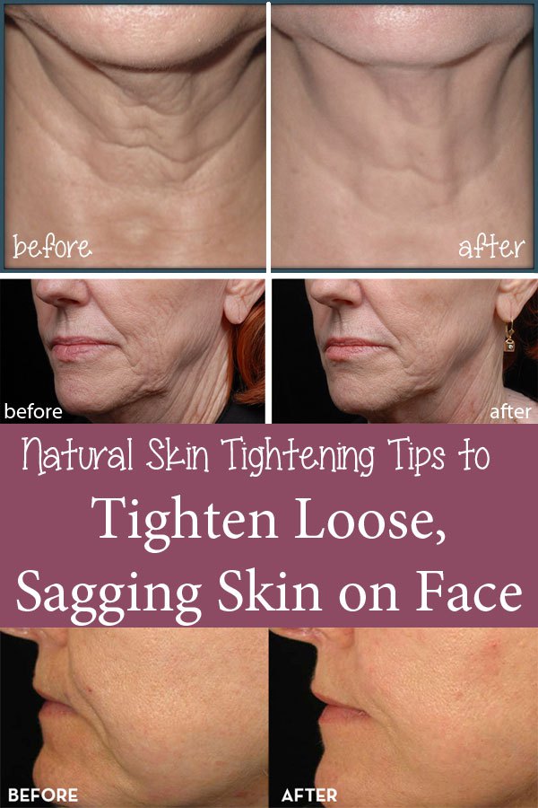 Organic tightening peel facial